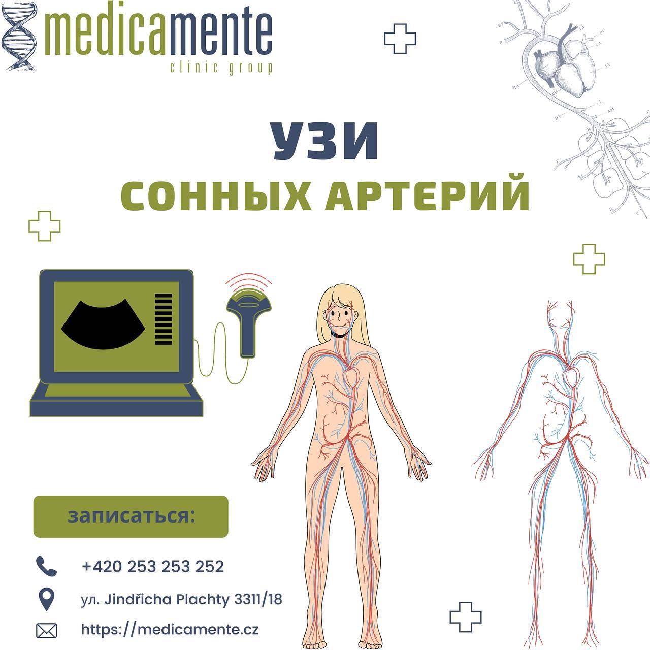 УЗИ СОННЫХ АРТЕРИЙ